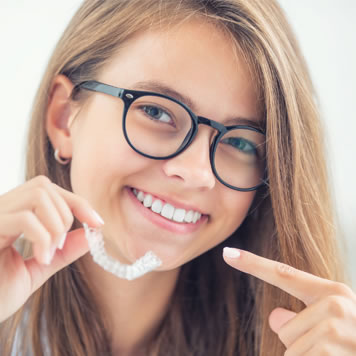 clear aligners